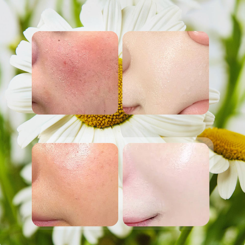 Maseczka do twarzy z różą, wit – Face Mask Skincare recenzja i cena
